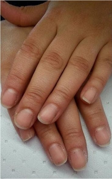 Natural nails before a manicure at MSpa